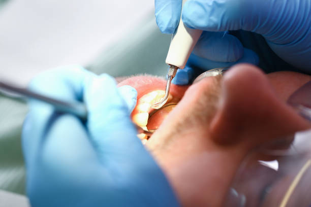Best Emergency Dentist for Knocked-Out Tooth in Norman Park, GA