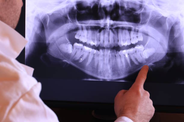 Best Emergency Dental Services for Seniors in Norman Park, GA